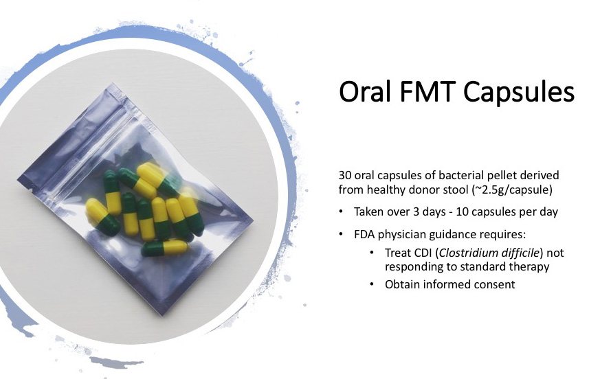 This image has an empty alt attribute; its file name is Oral-FMT-capsules.jpg